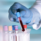 Guardant Health is one company that aims to use liquid biopsy and advanced digital sequencing technology to detect cancer even in its earliest stages. (Photo: Angellodeco l Shutterstock)
